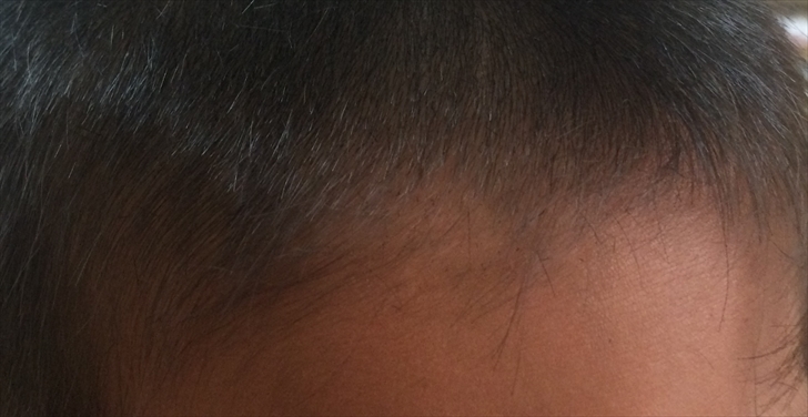 生え際を丁寧に切る